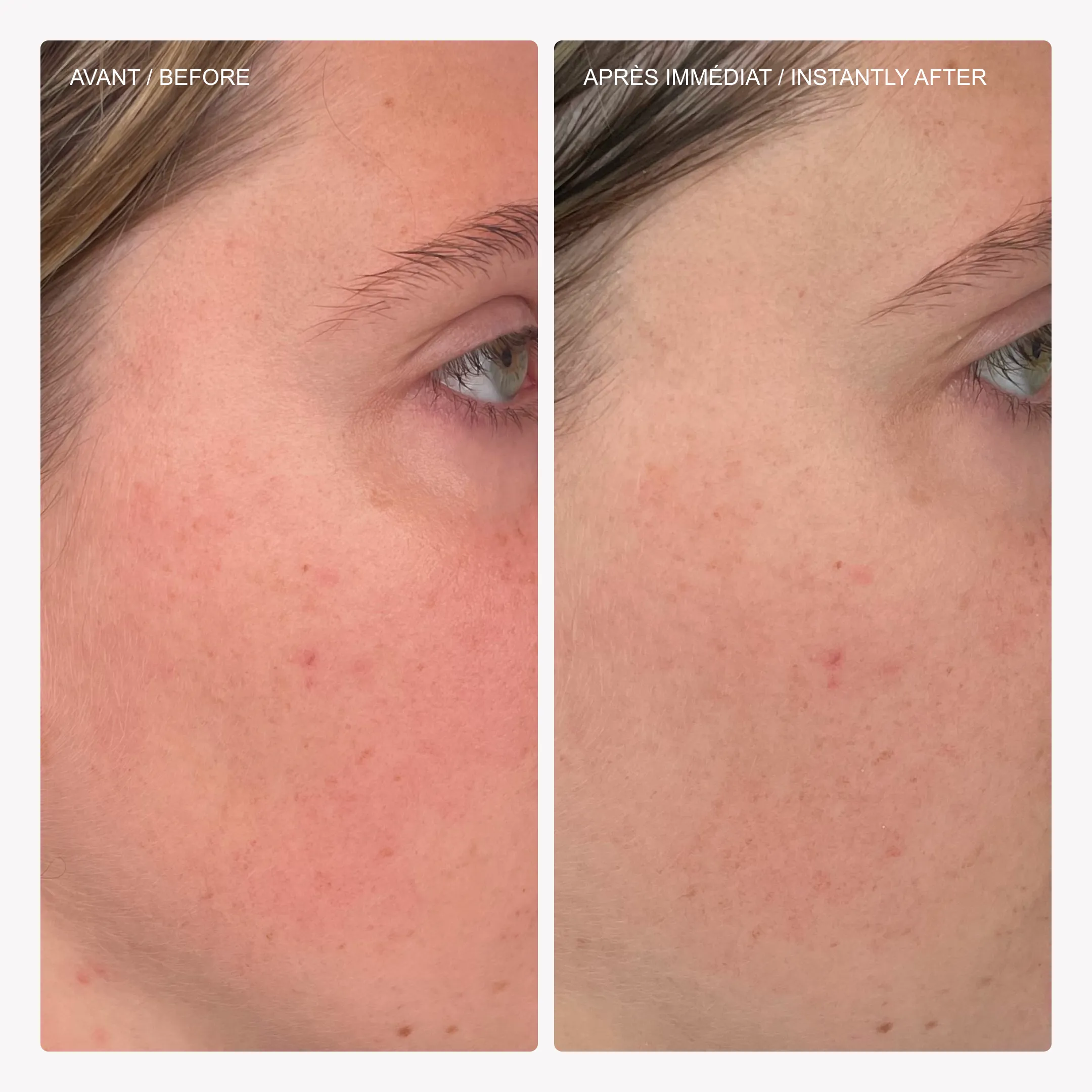 Gel micro-exfoliant doux à la trémelle - Image 4