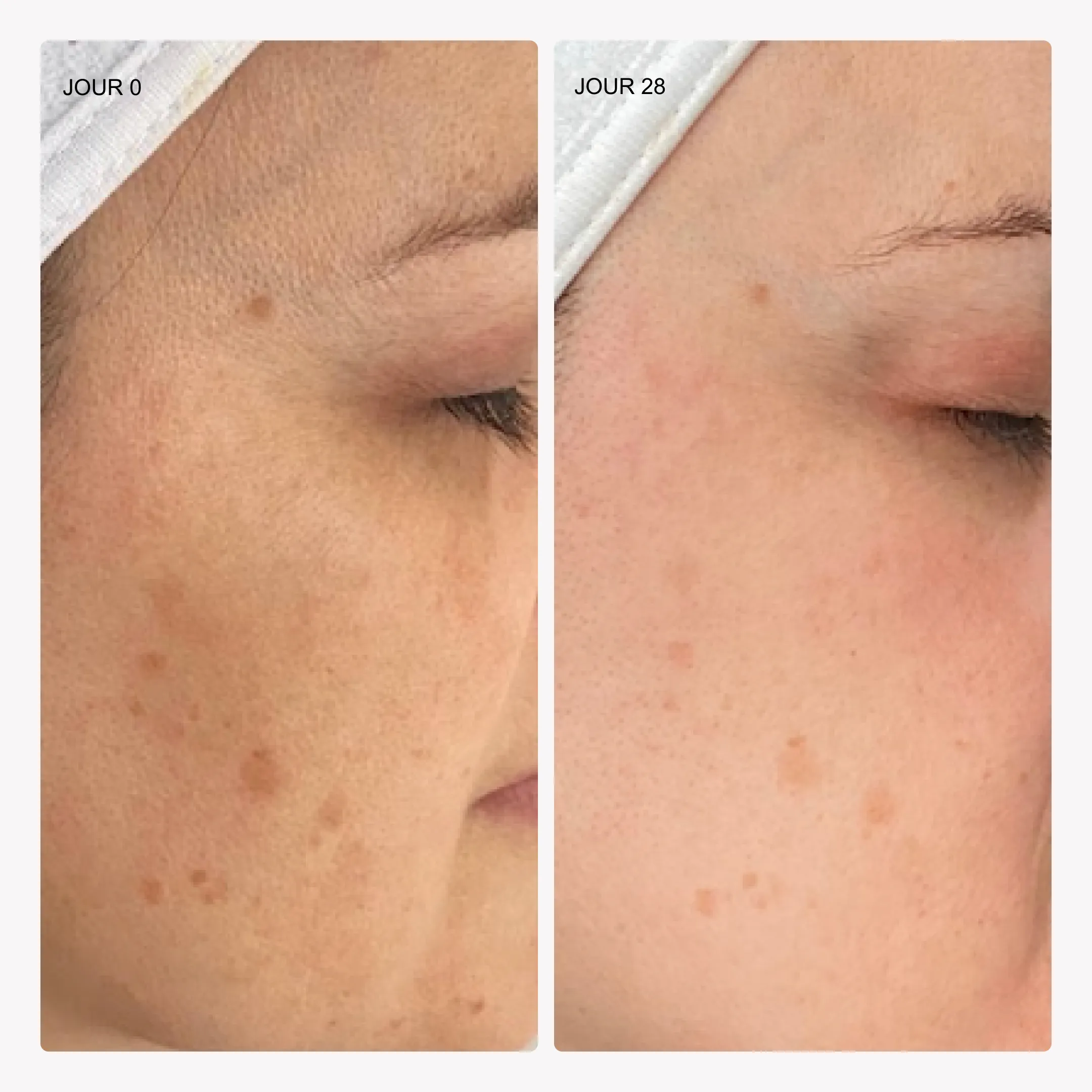 Huile pure - Vitamine C 5% + squalane - Image 4
