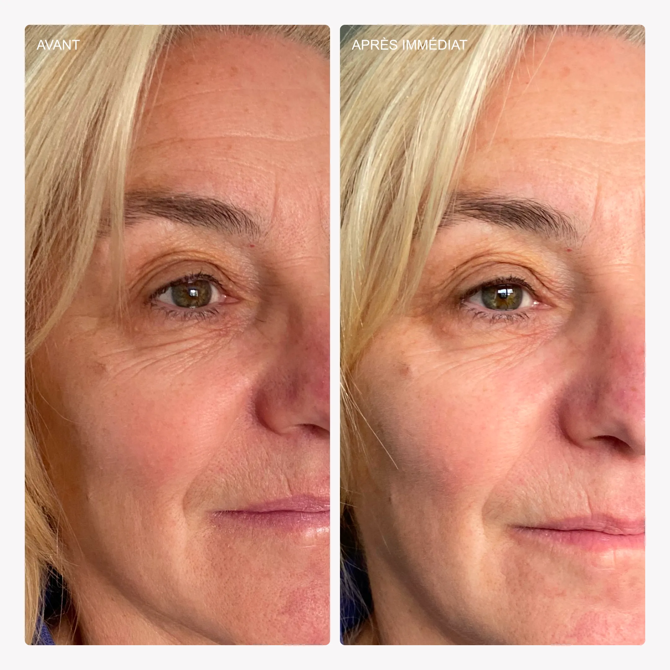 Masque visage tri-exfoliant - Image 4