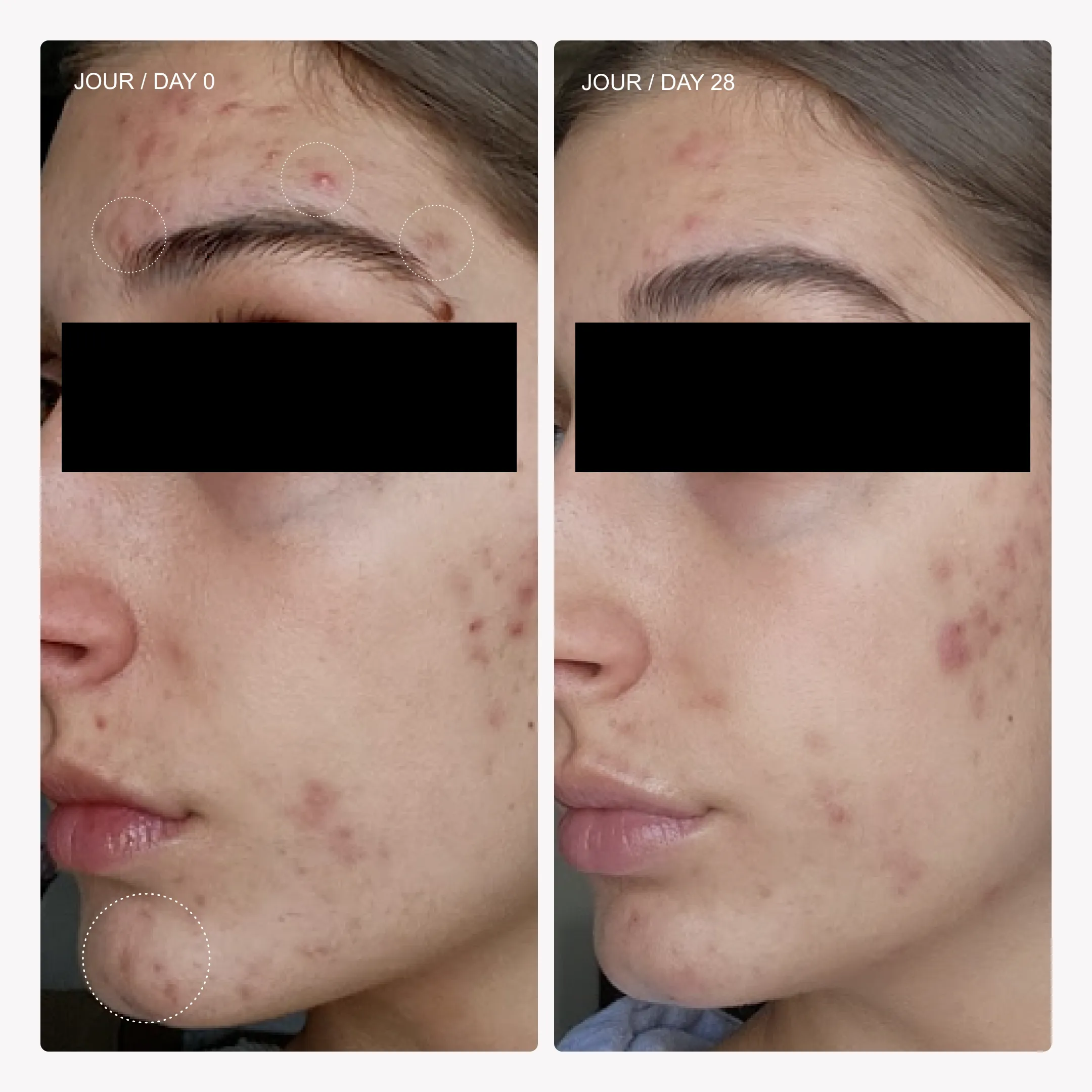 Sérum équilibrant* - Image 6
