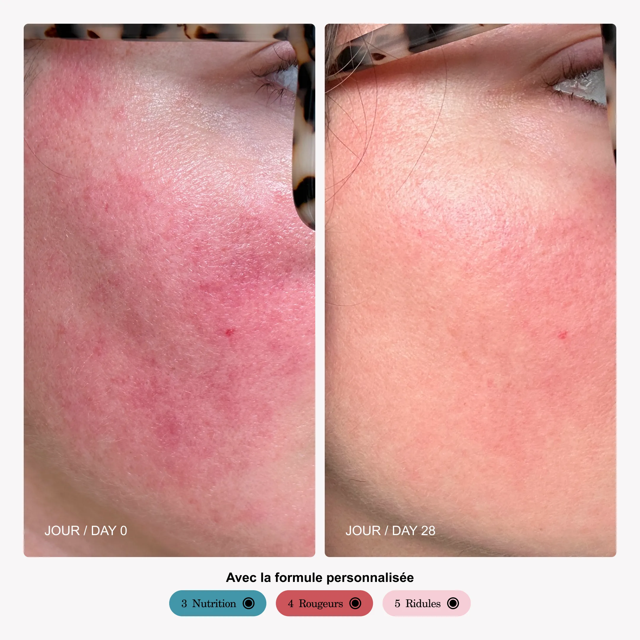 Sérum personnalisé 5% de Niacinamide - Image 7